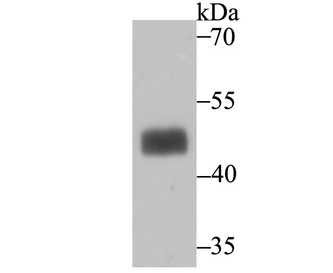 Anti-MAPKAPK2 Antibody (2M484)