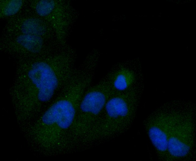 Anti-M-CSF/CSF1 Antibody (2H817)