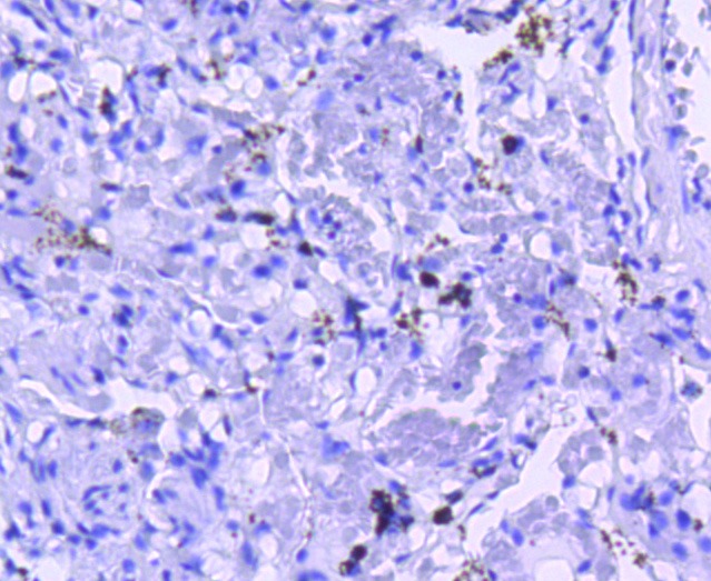 Anti-M-CSF/CSF1 Antibody (2H817)