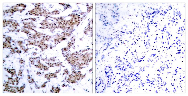 Anti-Phospho-MEF2A (Thr312) Polyclonal Antibody