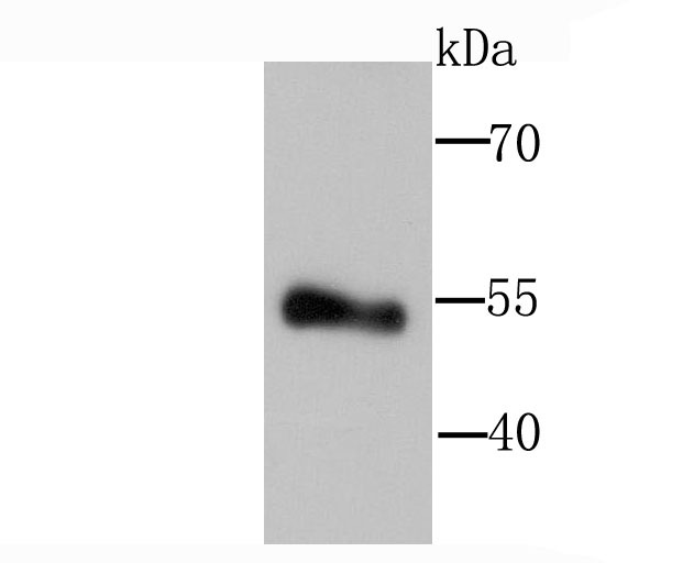 Anti-Lipoprotein lipase Antibody (3S505)