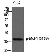 Anti-Phospho-Mcl-1 (Ser159) Polyclonal Antibody