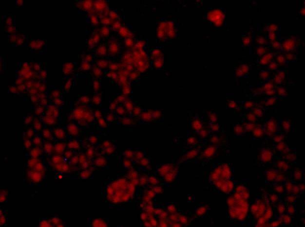 Anti-LMNB2 Antibody (2J173)