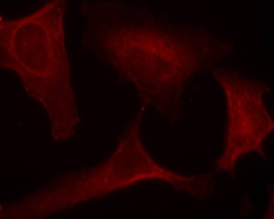 Anti-Phospho-MAP2K1 (Ser221) Polyclonal Antibody