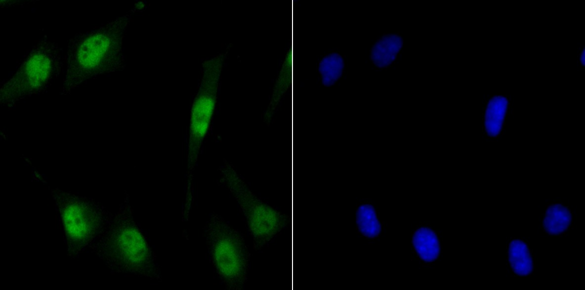 Anti-MCM3 Antibody (3T338)