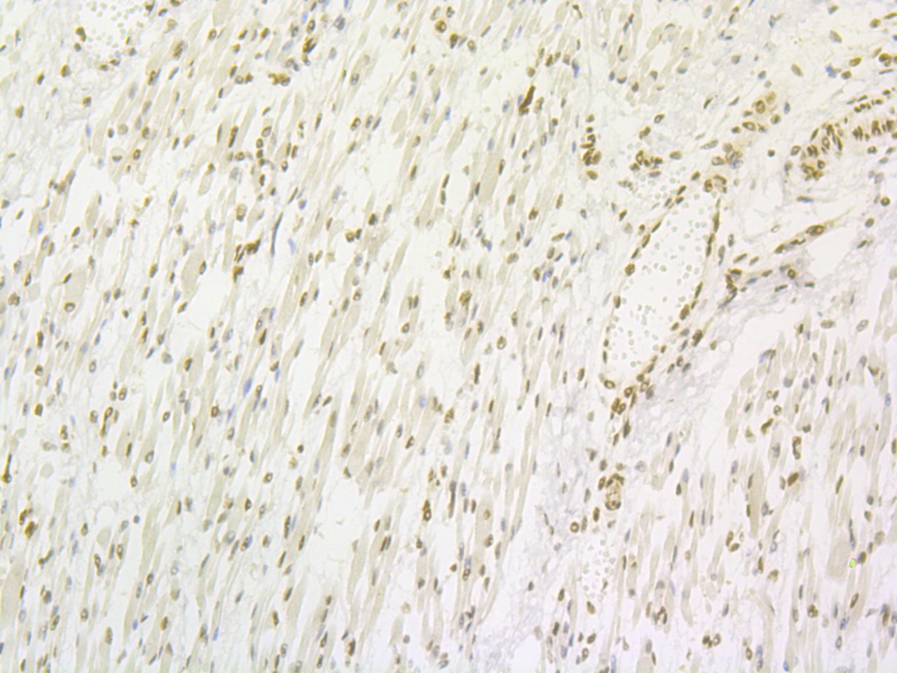 Anti-Lipin 1 Antibody (5B766)