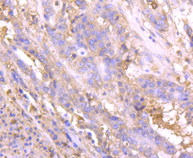 Anti-Lipocalin-2/LCN2 Antibody (7K2)