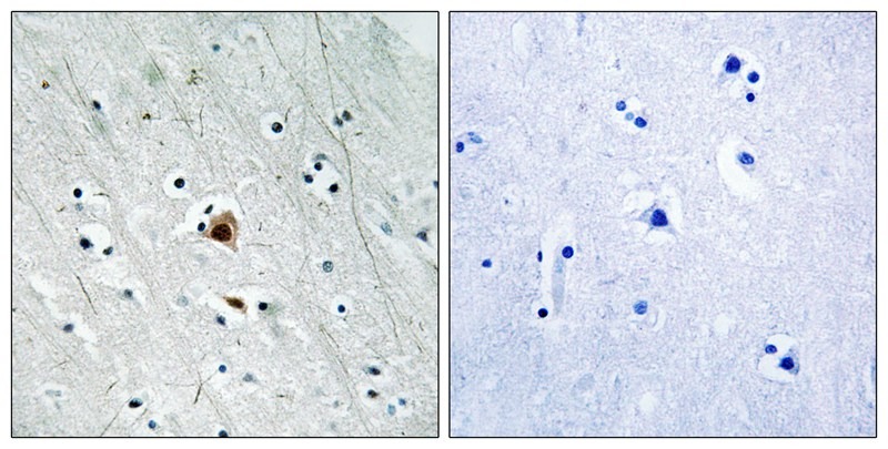 Anti-Phospho-MAPKAPK2 (Ser272) Polyclonal Antibody
