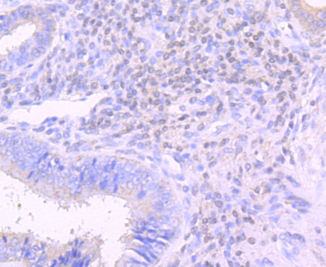 Anti-Lipocalin-2/LCN2 Antibody (7K2)