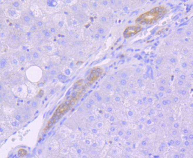 Anti-MSI2 Antibody (1Q704)