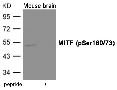 Anti-Phospho-MITF (Ser180, 73) Polyclonal Antibody