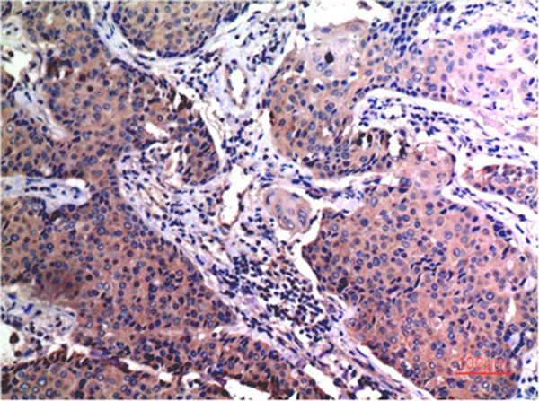 Anti-MMP-2 Antibody (5L604)
