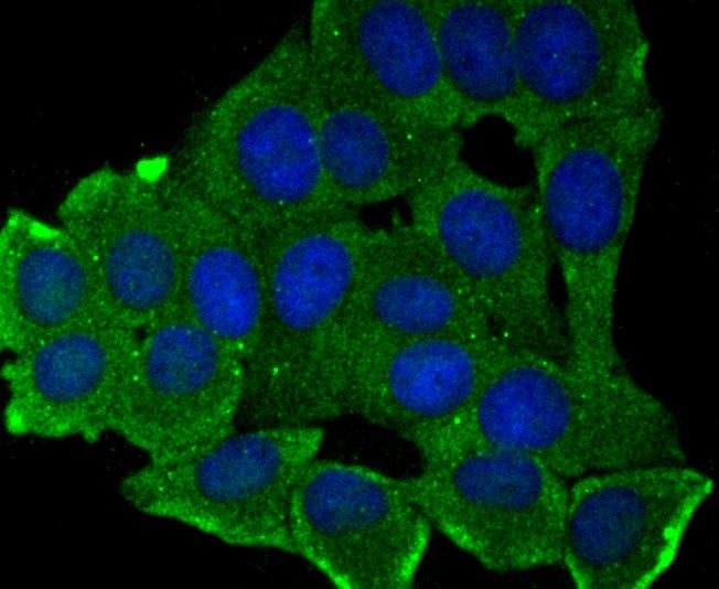 Anti-MMP17 Antibody (1E489)