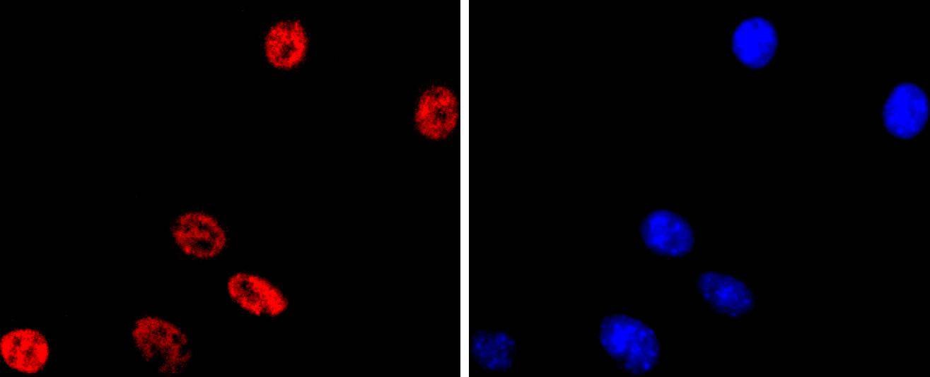 Anti-MITF Antibody (9E208)