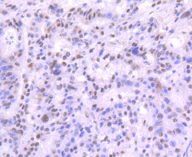Anti-MRE11 Antibody (6B152)