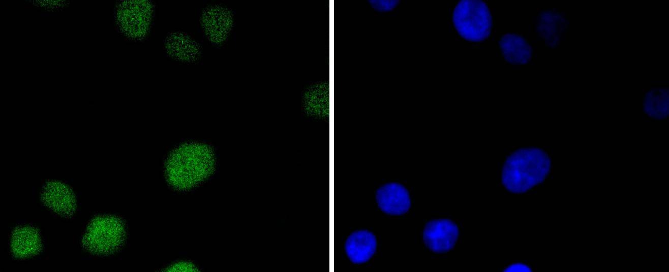 Anti-MSH6 Antibody (6V732)