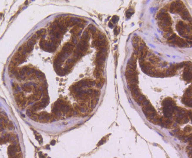 Anti-MSI2 Antibody (1Q704)