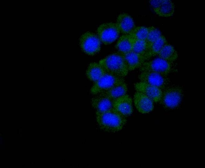 Anti-MSI2 Antibody (1Q704)