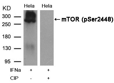 Anti-Phospho-mTOR (Ser2448) Polyclonal Antibody 2