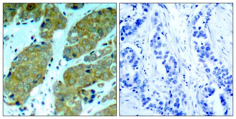 Anti-Phospho-mTOR (Ser2448) Polyclonal Antibody 2