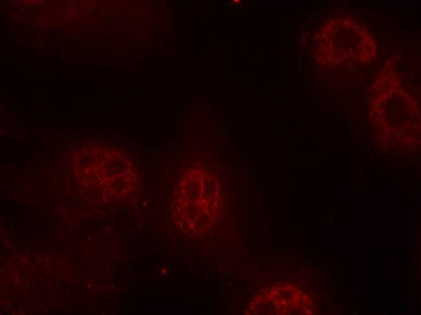 Anti-Phospho-MYC (Ser62) Polyclonal Antibody