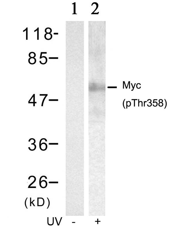 Anti-Phospho-MYC (Thr358) Polyclonal Antibody