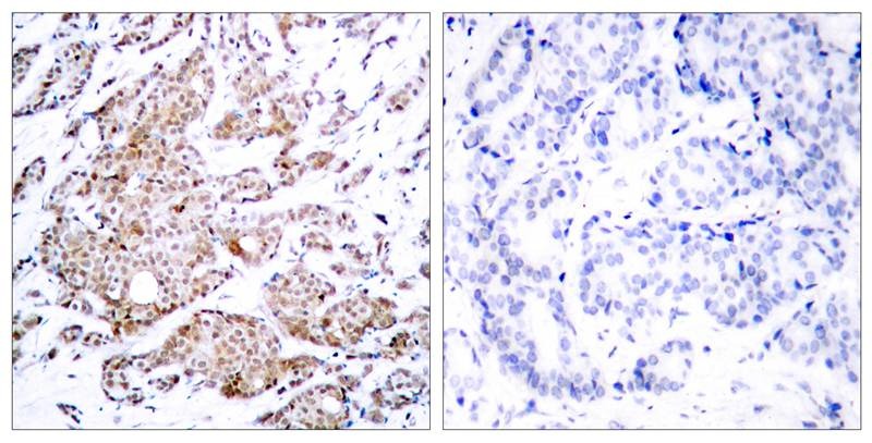 Anti-Phospho-MYC (Thr58) Polyclonal Antibody