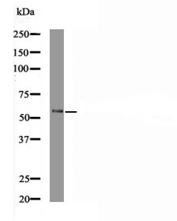 Anti-Phospho-MST1 (Tyr433) Polyclonal Antibody