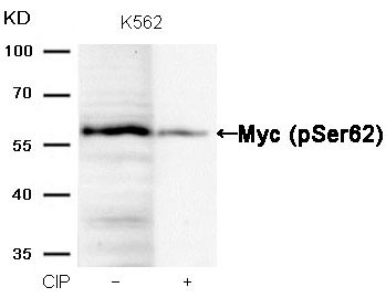 Anti-Phospho-MYC (Ser62) Polyclonal Antibody