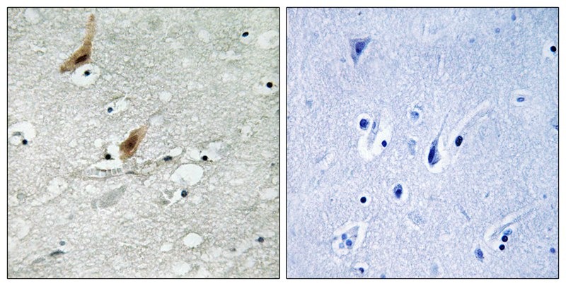 Anti-Phospho-MSK2 (Thr568) Polyclonal Antibody