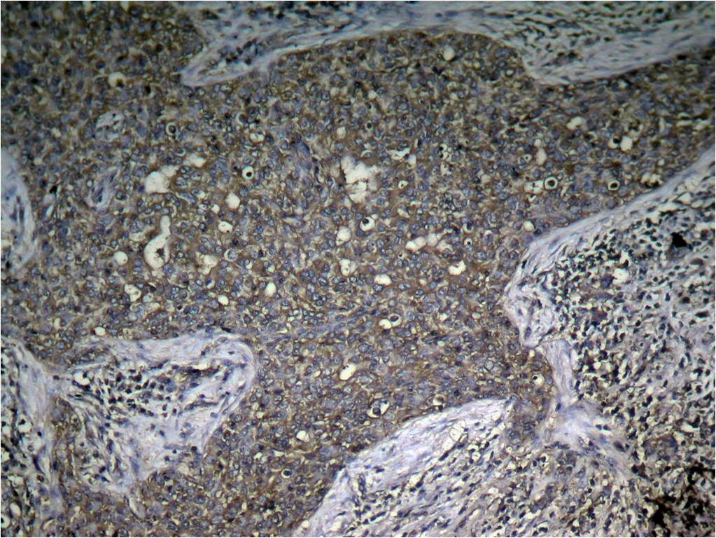 Anti-Phospho-mTOR (Ser2448) Polyclonal Antibody 2