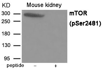 Anti-Phospho-mTOR (Ser2481) Polyclonal Antibody 2