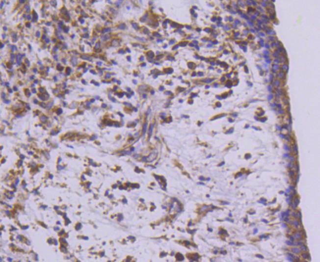 Anti-MEKK2 Antibody (5G332)