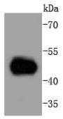 Anti-MEK5 Antibody (4P780)