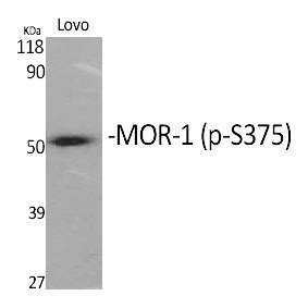 Anti-Phospho-OPRM1 (Ser375) Polyclonal Antibody 2