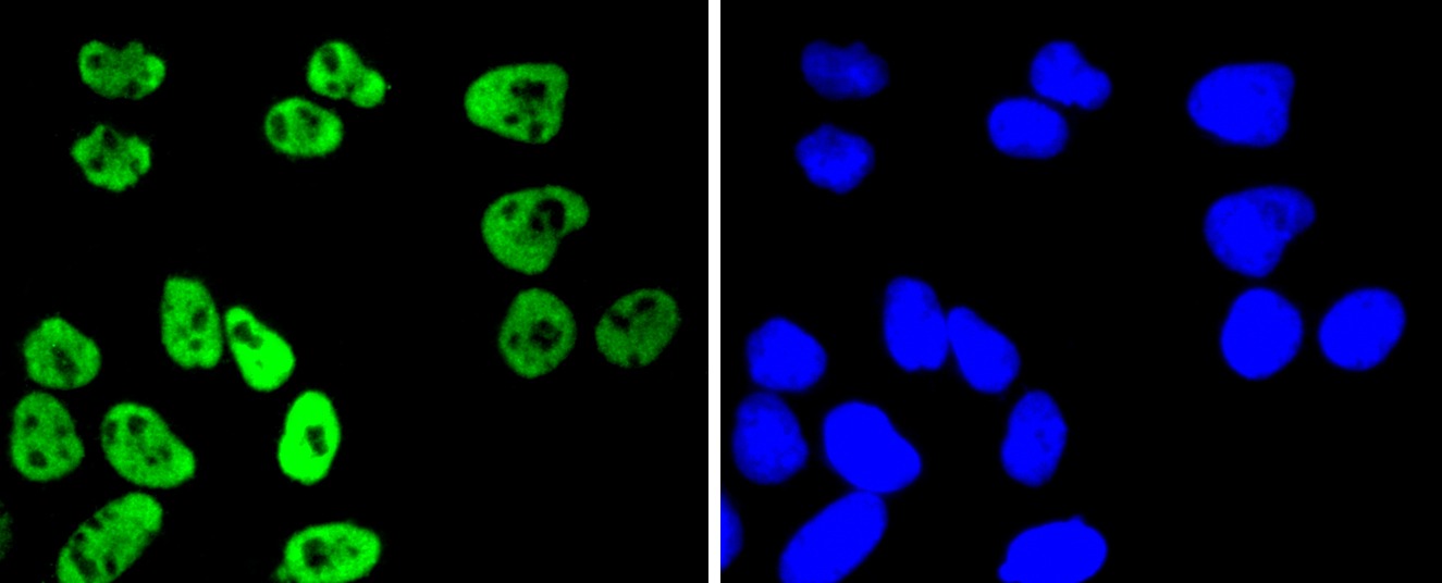 Anti-Phospho-RPS6KA5 (Ser376) Antibody (8P256)