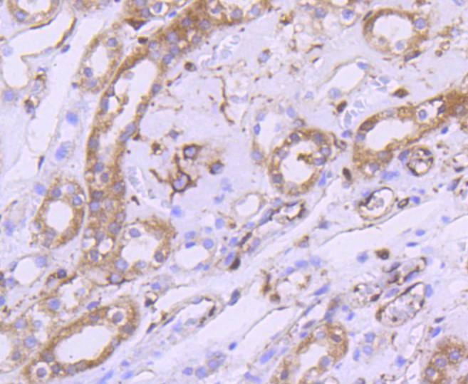 Anti-mTOR Antibody (7U757)