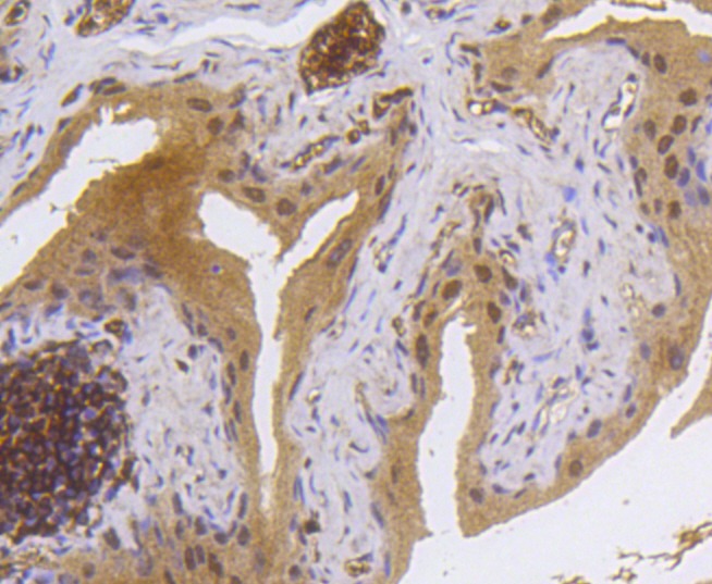 Anti-Phospho-RPS6KA5 (Ser376) Antibody (8P256)