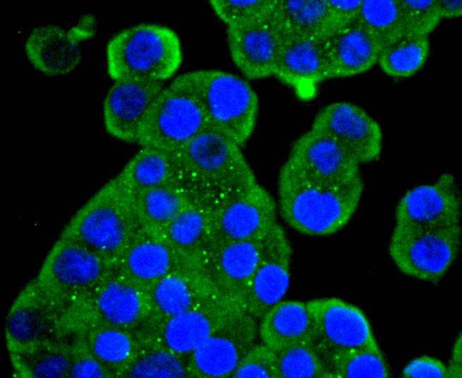Anti-MEK5 Antibody (4P780)
