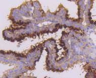 Anti-STK3 Antibody (1D681)