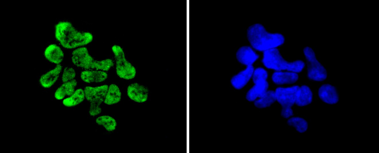 Anti-Phospho-RPS6KA5 (Ser376) Antibody (8P256)