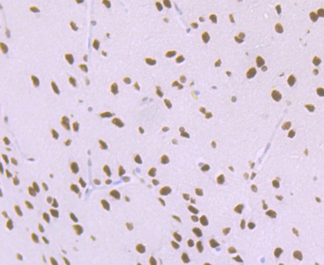 Anti-Matrin 3 Antibody (7P173)