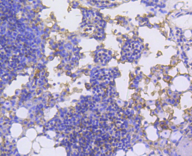 Anti-LSP1 Antibody (1E727)
