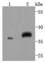 Anti-MAP2K3/MAP2K6 Antibody (7F635)