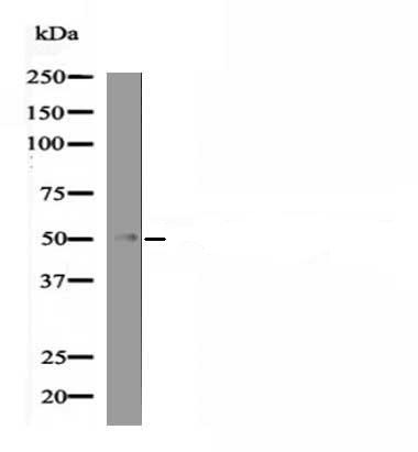 Anti-Phospho-MEF2C (Ser222) Polyclonal Antibody