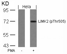 Anti-Phospho-LIMK2 (Thr505) Polyclonal Antibody
