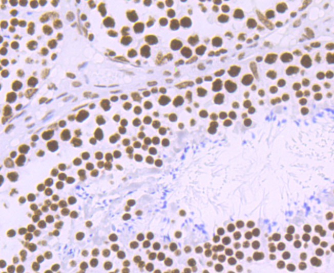 Anti-Matrin 3 Antibody (7P173)