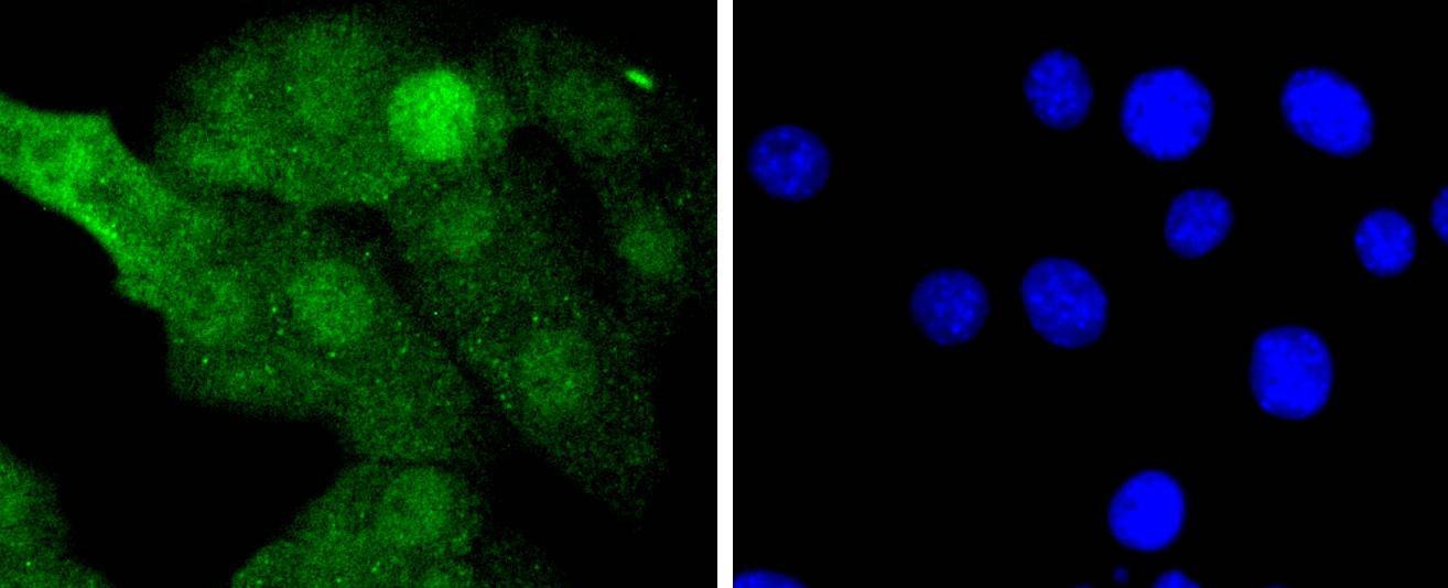 Anti-MAP2K3/MAP2K6 Antibody (7F635)