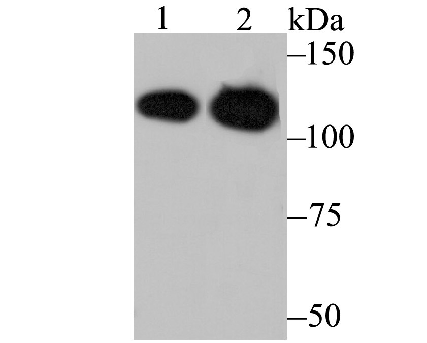Anti-Matrin 3 Antibody (7P173)