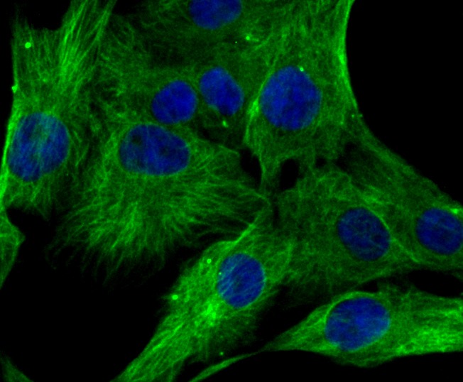 Anti-Lumican Antibody (9X464)